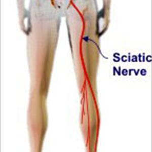 Sciatic Muscle Spasm - 3 Simple Tests For Back Pain