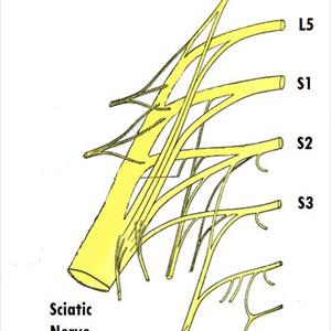 Sciatic Hip Pain - Sciatica Treatment