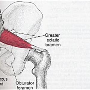 Sciatica Leg Exercises - Sciatica: Cause And Diagnosis